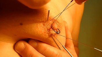 Play piercing with acupuncture needles